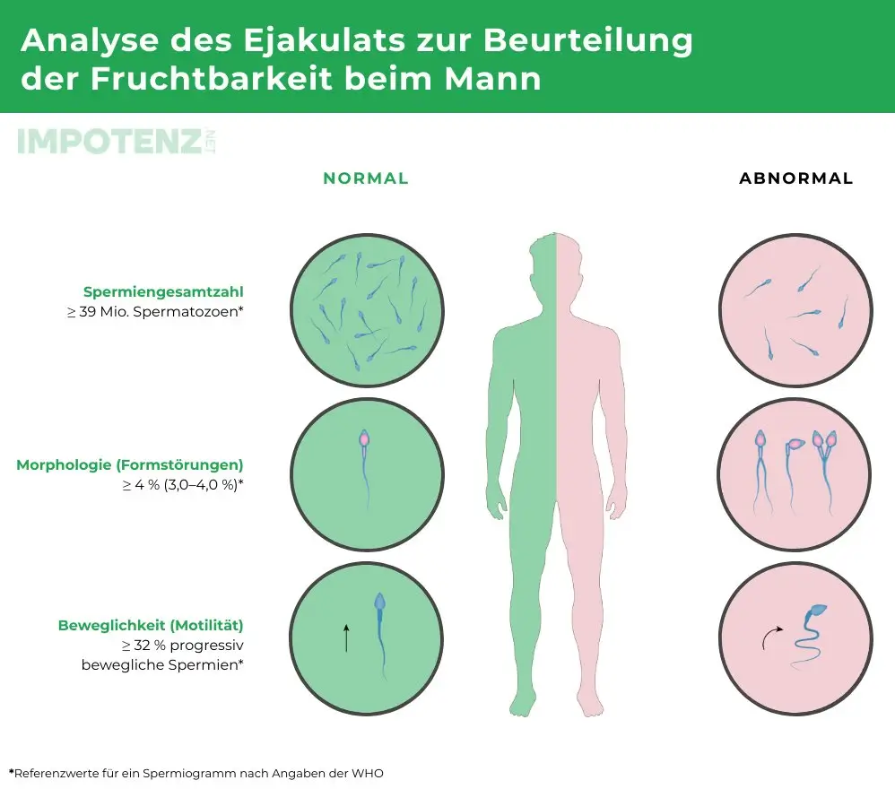 Spermiogramm Grafik: normale und auffällige Spermien bei Anzahl, Form und Beweglichkeit