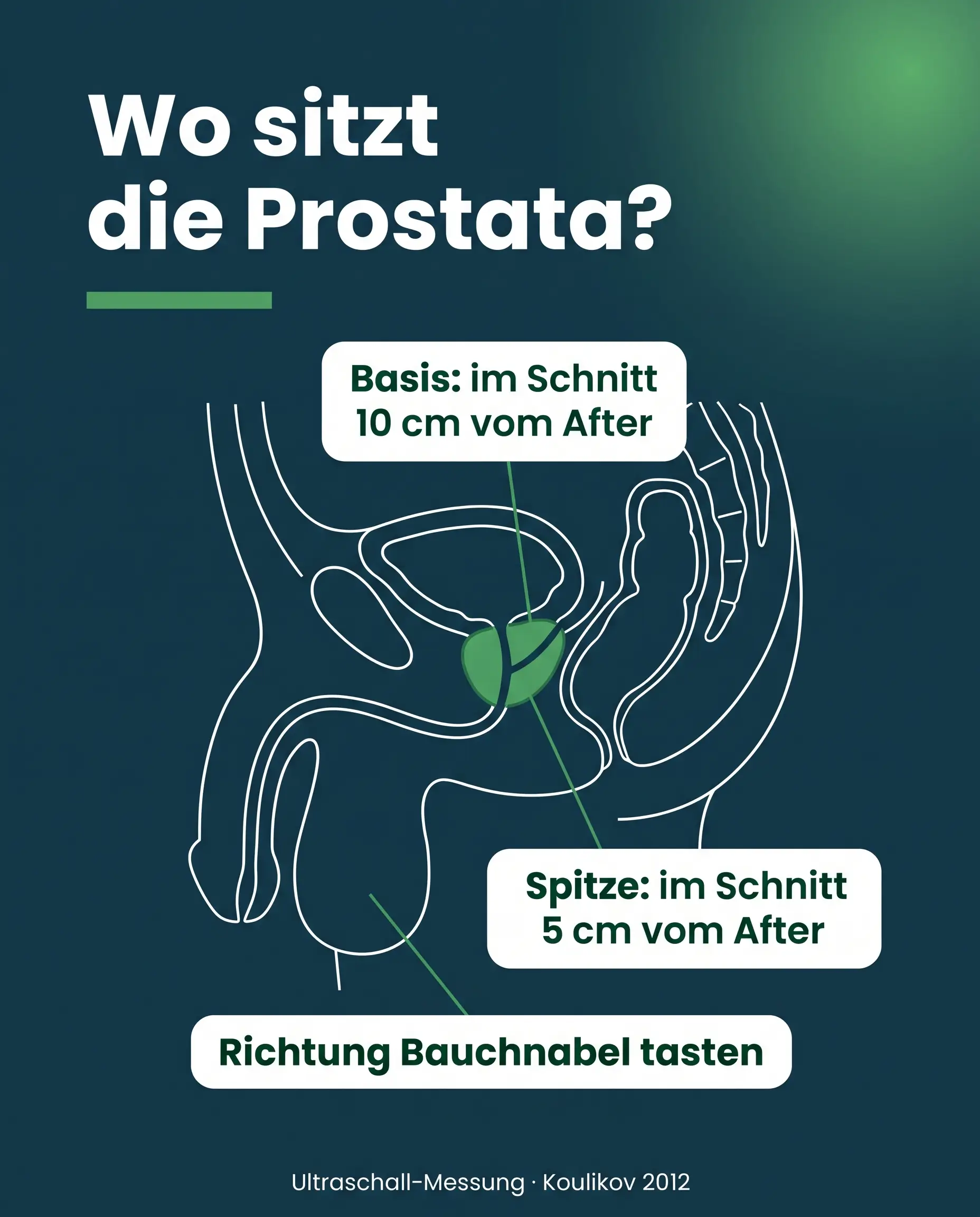Infografik: Lage der Prostata für die Zwangsentsamung, Spitze 5 cm und Basis 10 cm vom After
